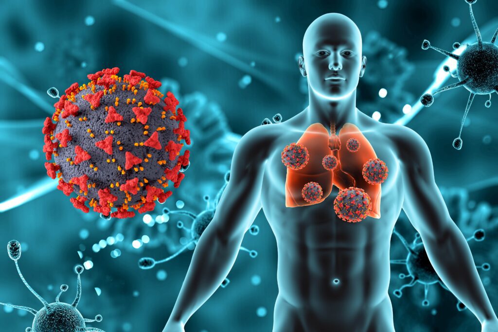 Tuberculsis